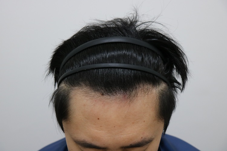 1년-45도.jpg