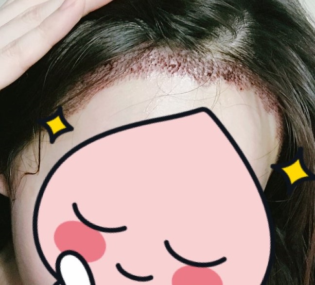 KakaoTalk_20180801_105401560.jpg