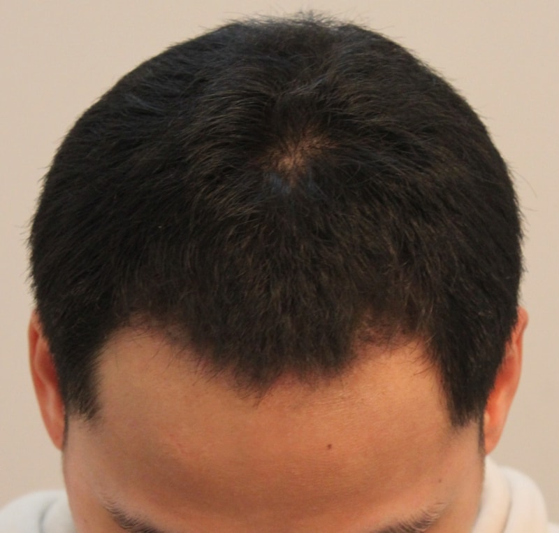 3달1.JPG