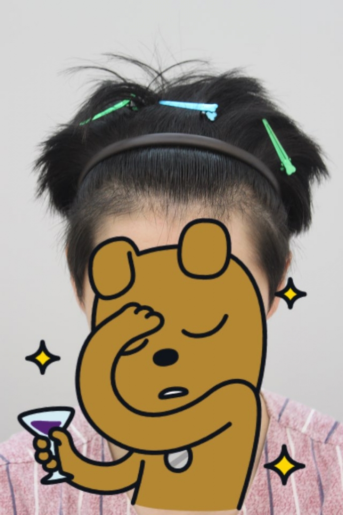 비절개 수술 미루다 미루다 드디어 받았습니다