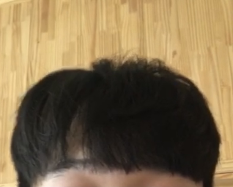 암흑기 덮머리중.png