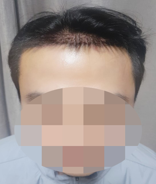 7일 (1).jpg