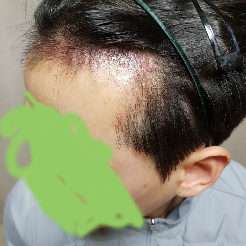 1달차 (3).jpg