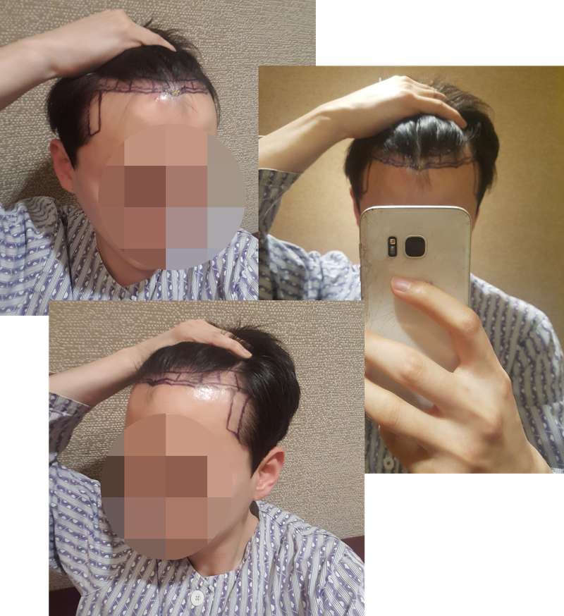 1개월까지의 과장 한번 올려봅니다.