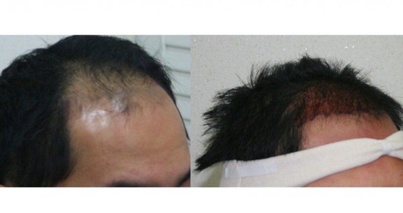 before&after.jpg
