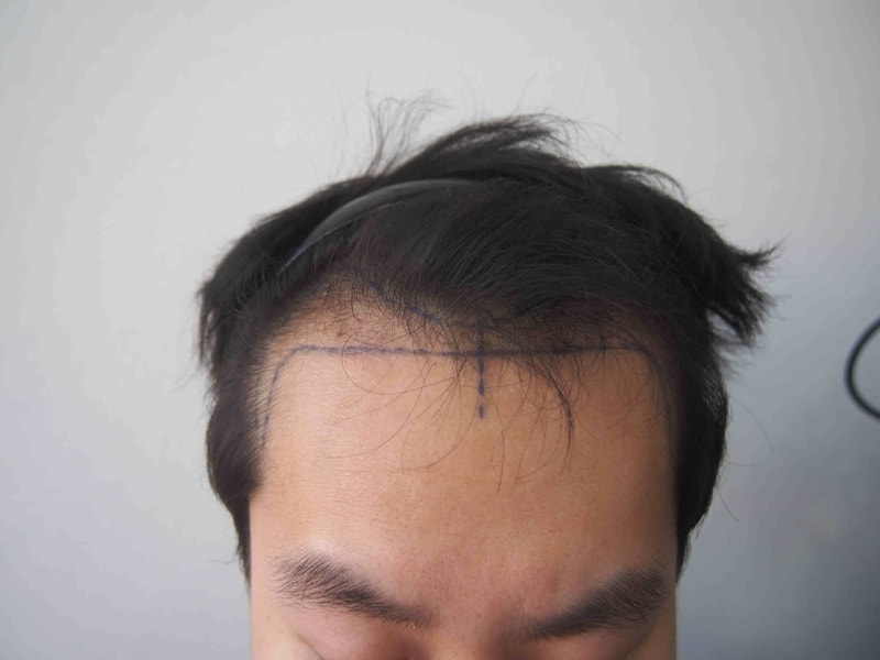 수술전 1.JPG