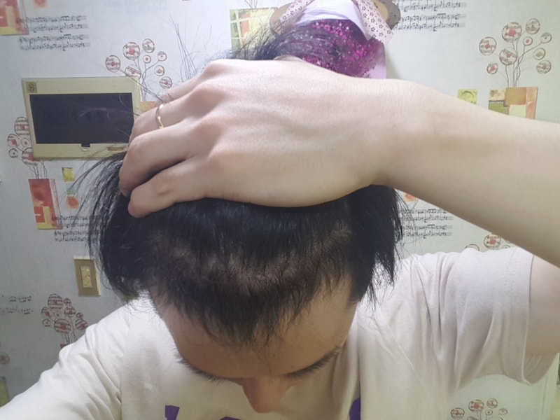모발3.jpg