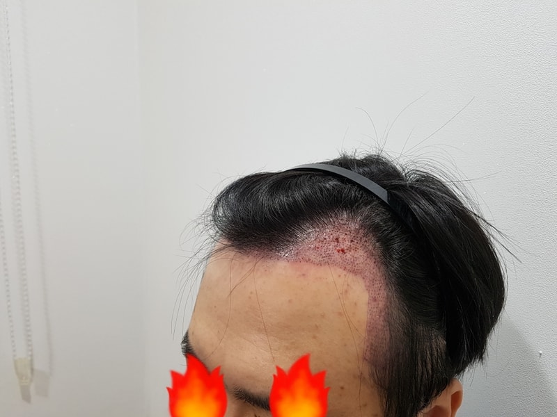 20180207_133035.jpg