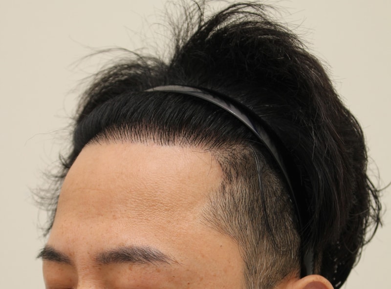1년편집 좌측면.jpg