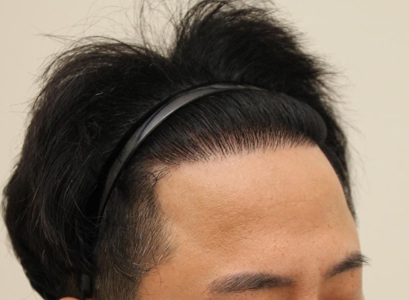 1년 편집 우측면.jpg