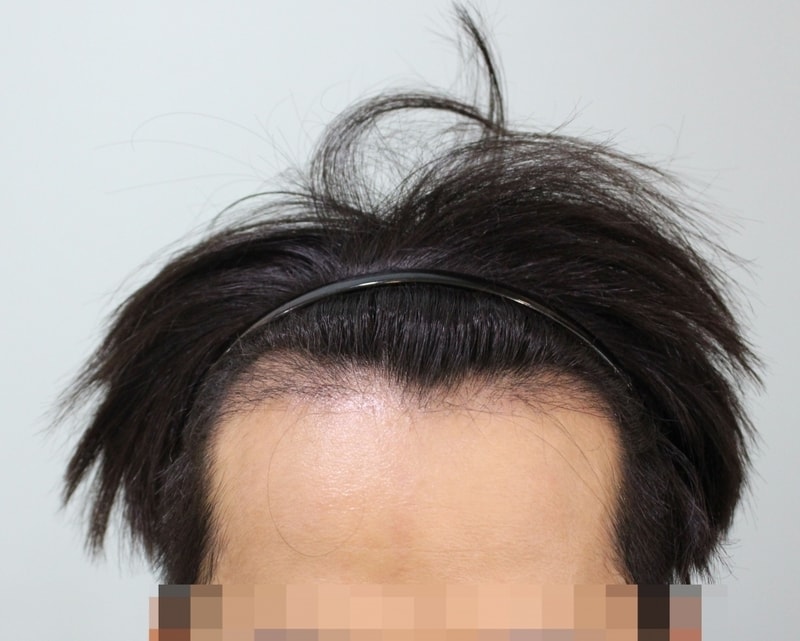 정면.jpg