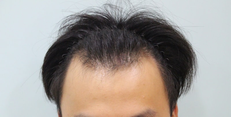 수술전 (7).JPG