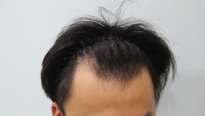 수술전 (5).JPG