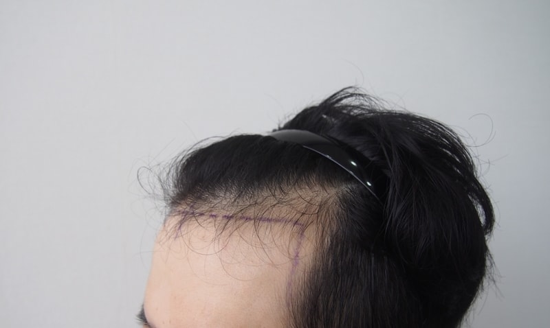 3번.jpg