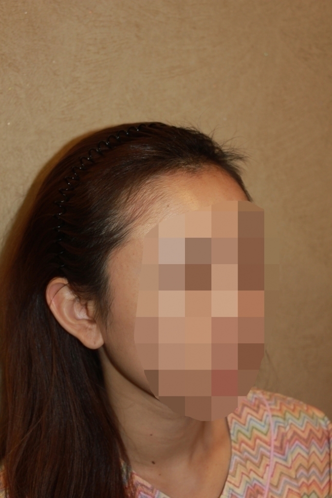 1_before (2).JPG
