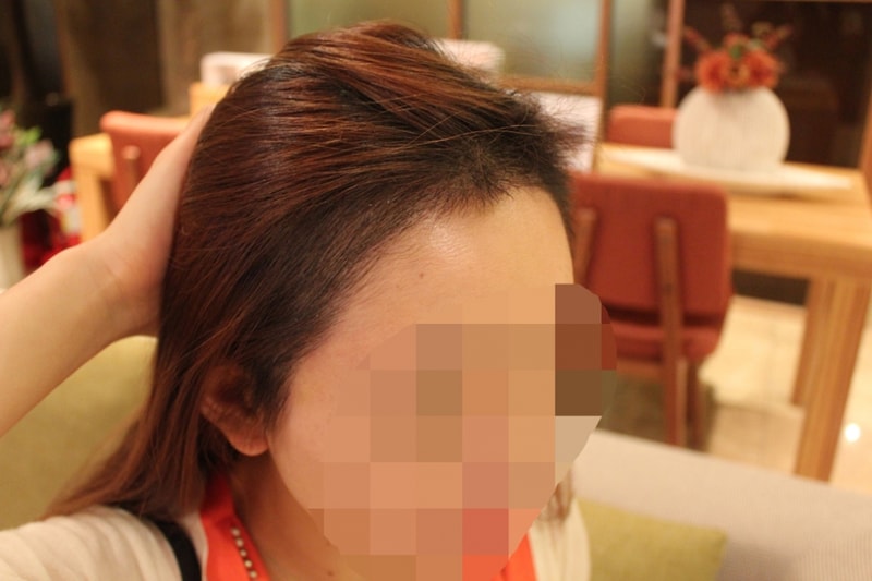 2_After_10일 (2).jpg