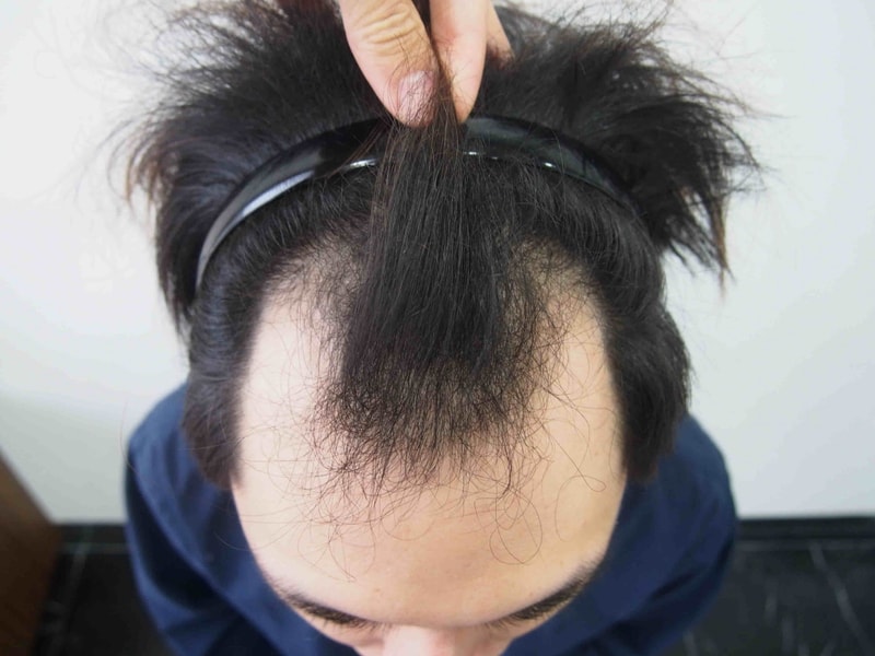 수술전 1.JPG