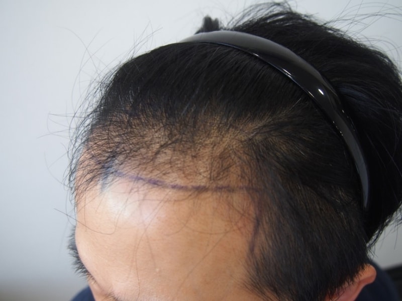 수정됨_M자_디자인(좌측면).jpg