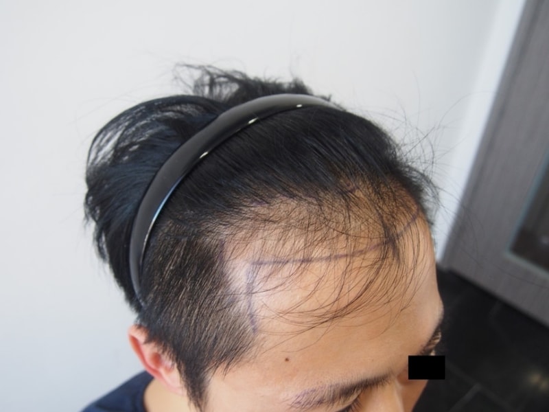 수정됨_M자_디자인(우측면).jpg