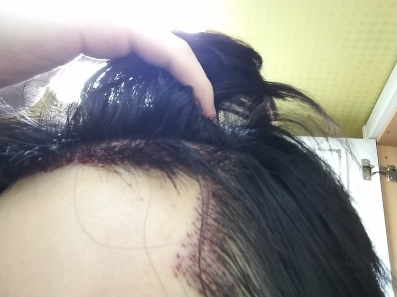 샴푸 후 1.jpg