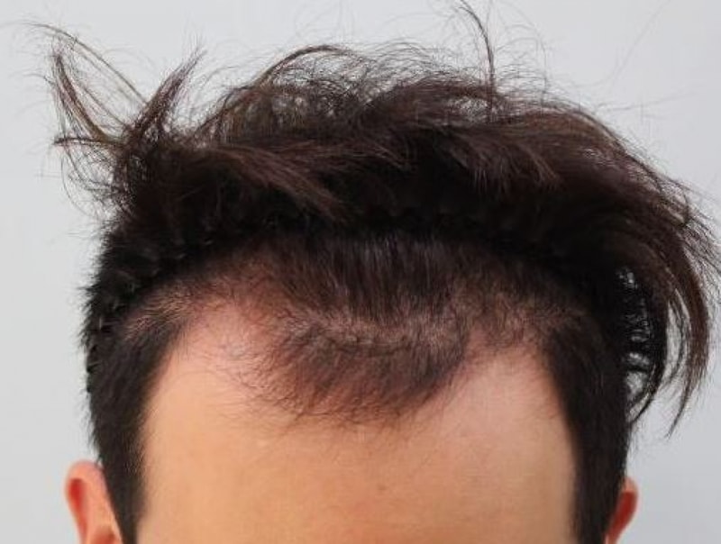 수술전..JPG