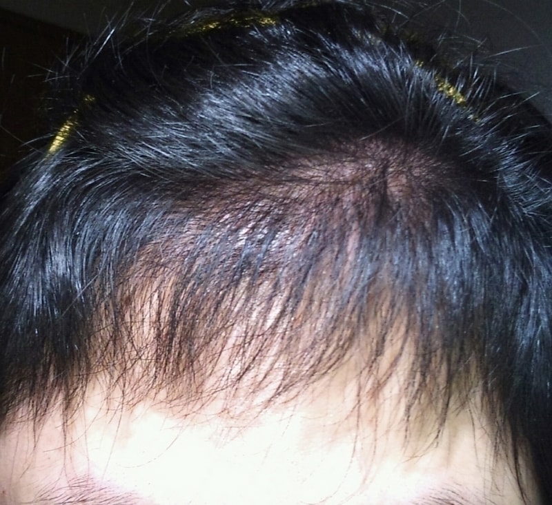 2011.03.03.1.jpg