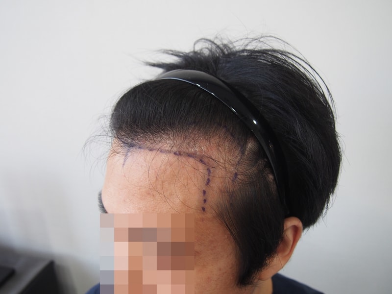 좌측_전.JPG