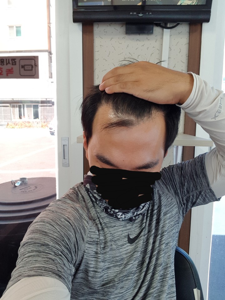 뉴헤어 1년후기입니다