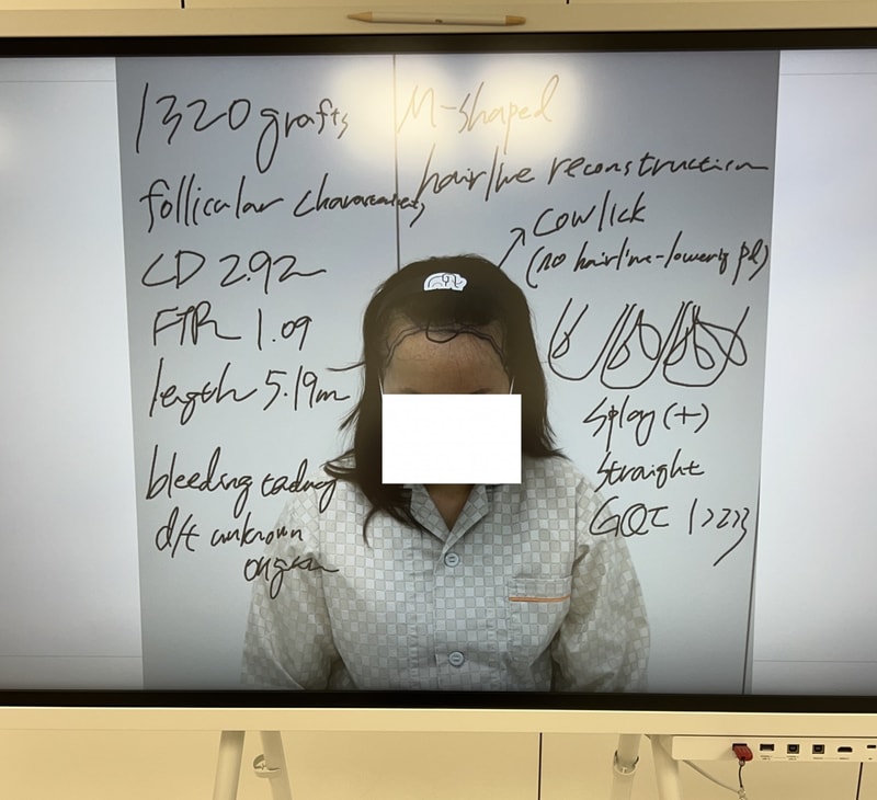 헤어라인3.jpg