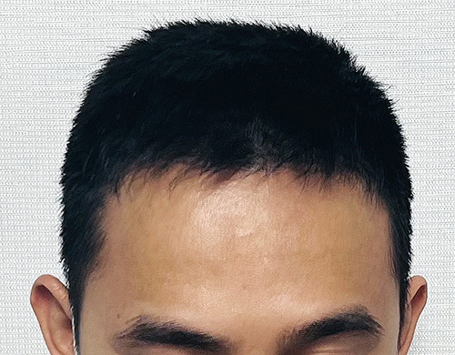 수술 후.jpg