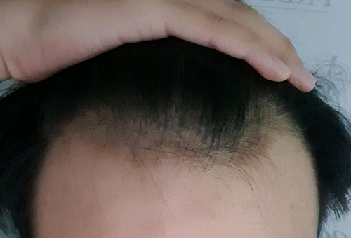전1.jpg