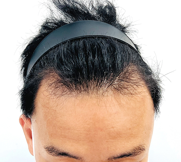 수술전01.jpg