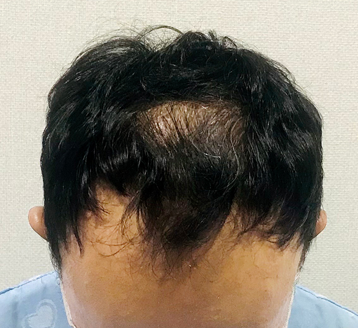 수술 전.jpg