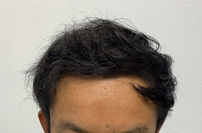 수술후01.jpg