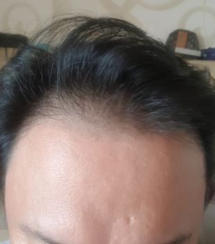 수술전1.JPG