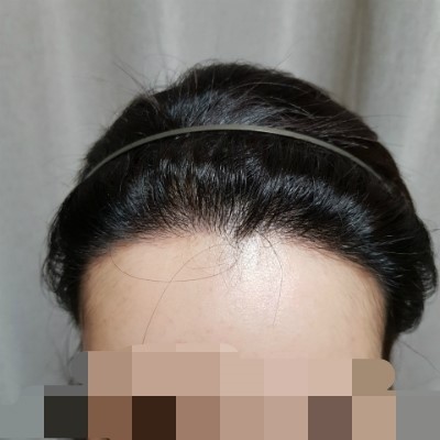 8개월차~ 올빽머리 밀도 만족합니다!