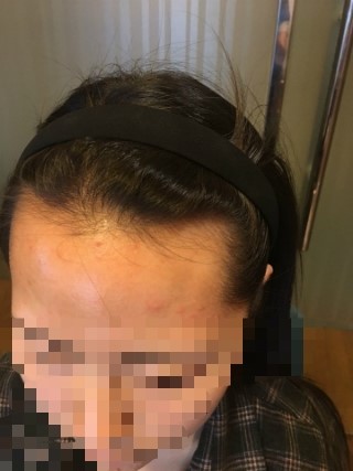 1년 지났어요!