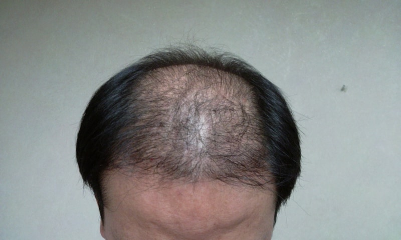 2011-02-23_11.44.22.jpg