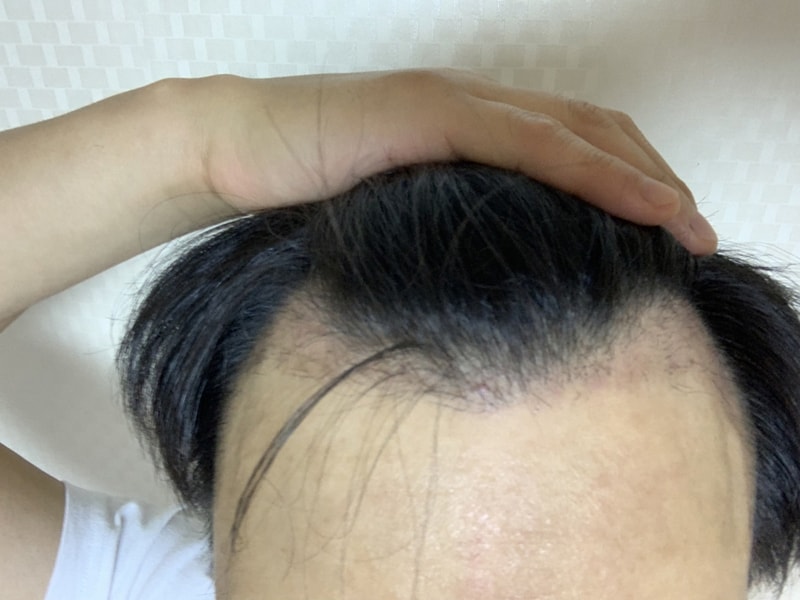 [크기변환]32일차_1.JPG
