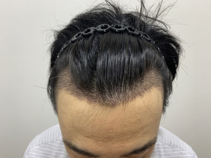 [크기변환]10일차_2.JPG