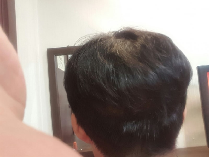 수정됨_뒷머리 덮음.jpg