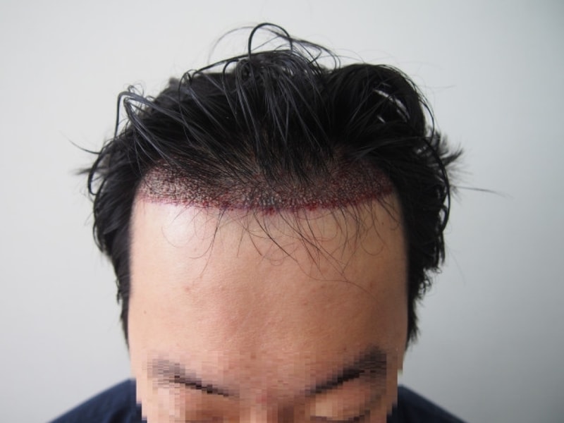 수정됨_수술후1.jpg