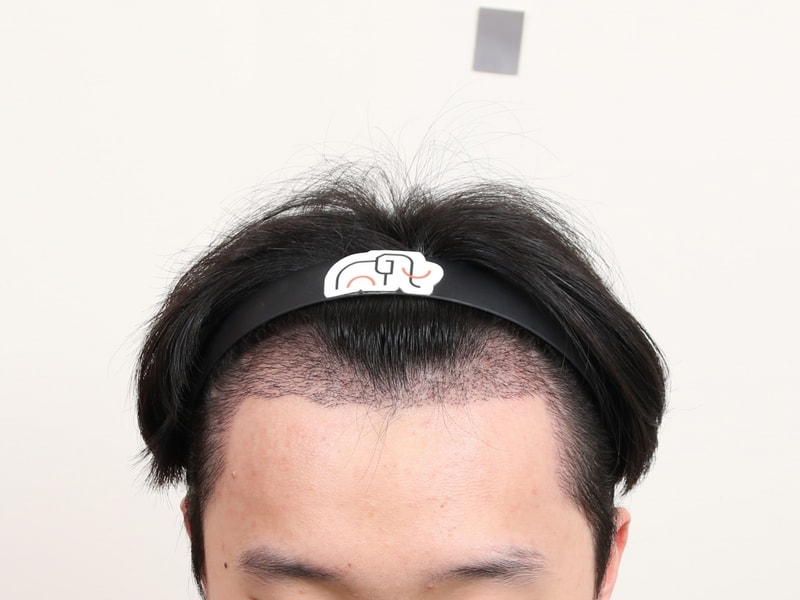 1000011635.jpg