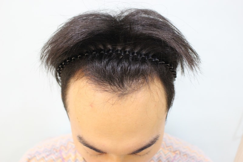 수술전 (3).JPG