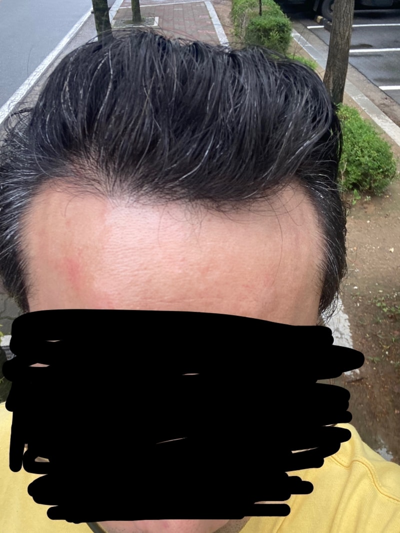 다나 롱헤어 무삭발 8개월