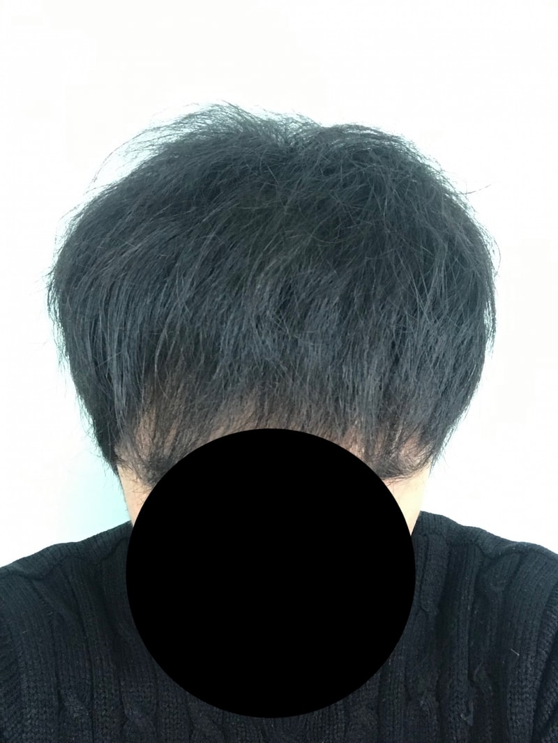 다나 롱헤어 무삭발 4개월