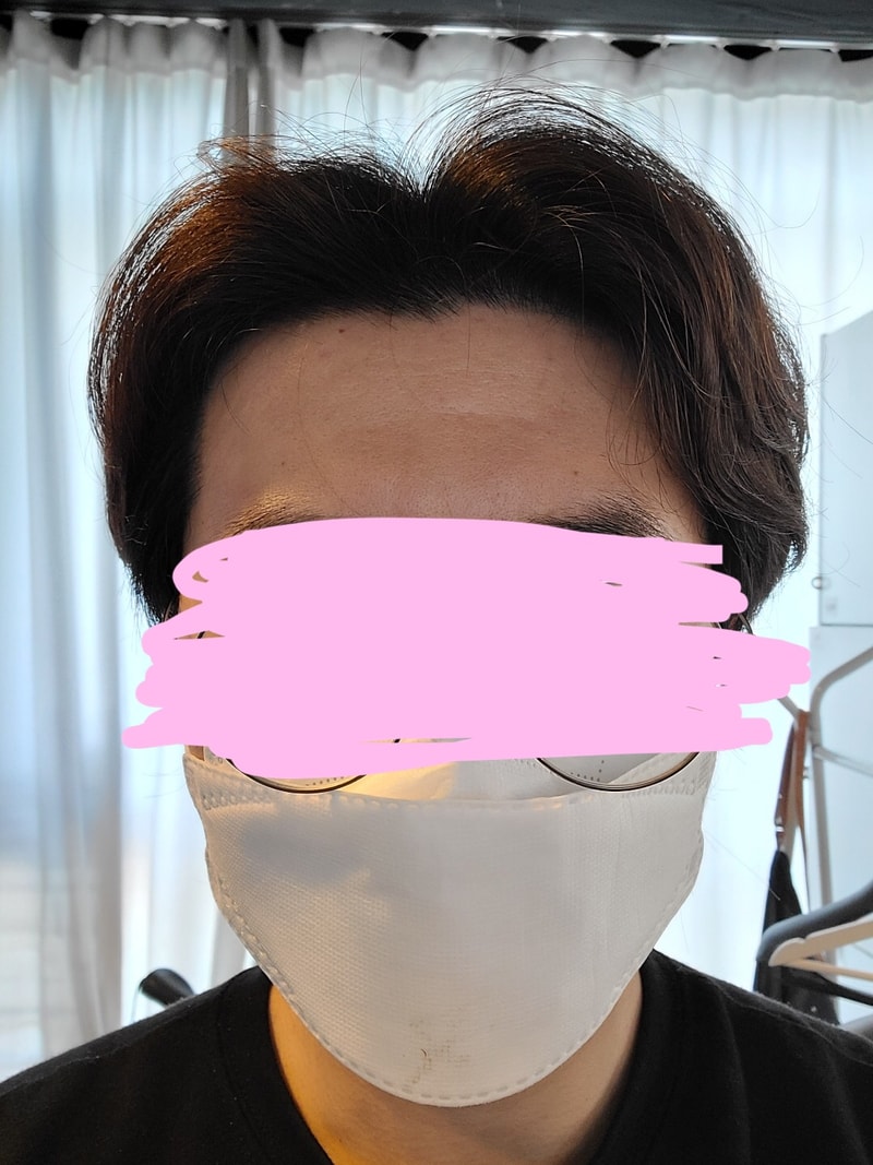 다나 무삭발 5개월
