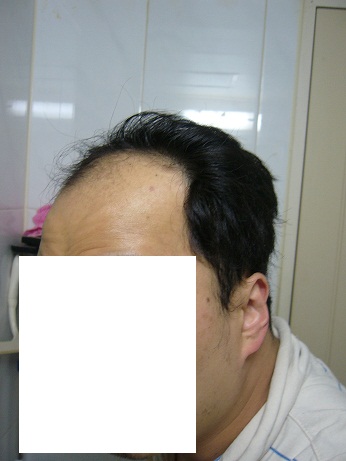 2009년 1차수술전 2.jpg