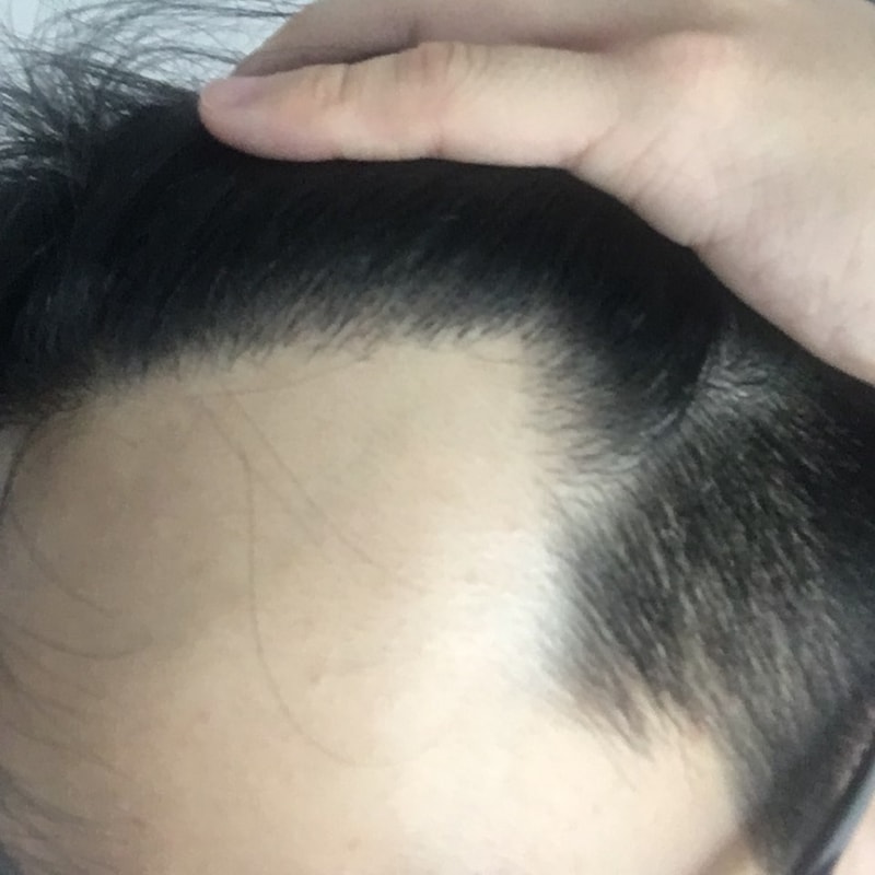오른쪽.jpg
