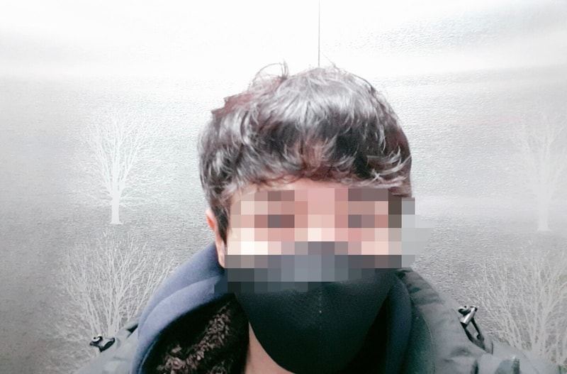 다나 무삭발 2개월 엘베에서